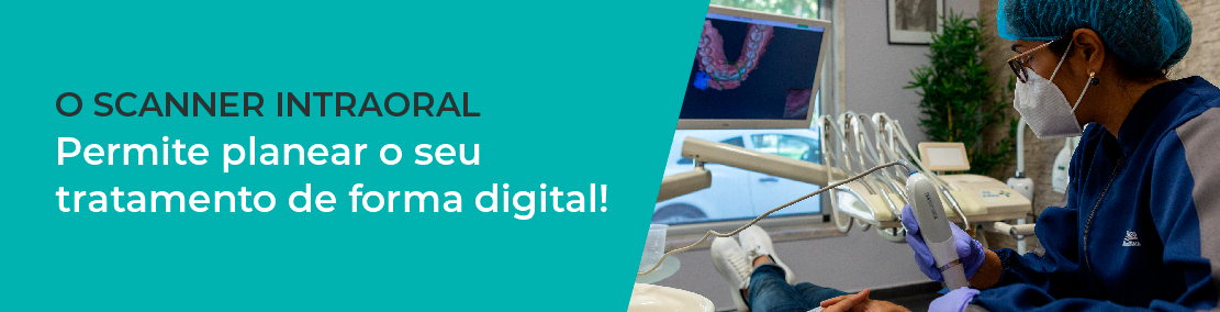O Scanner Intraoral permite planear o seu tratamento de forma digital!